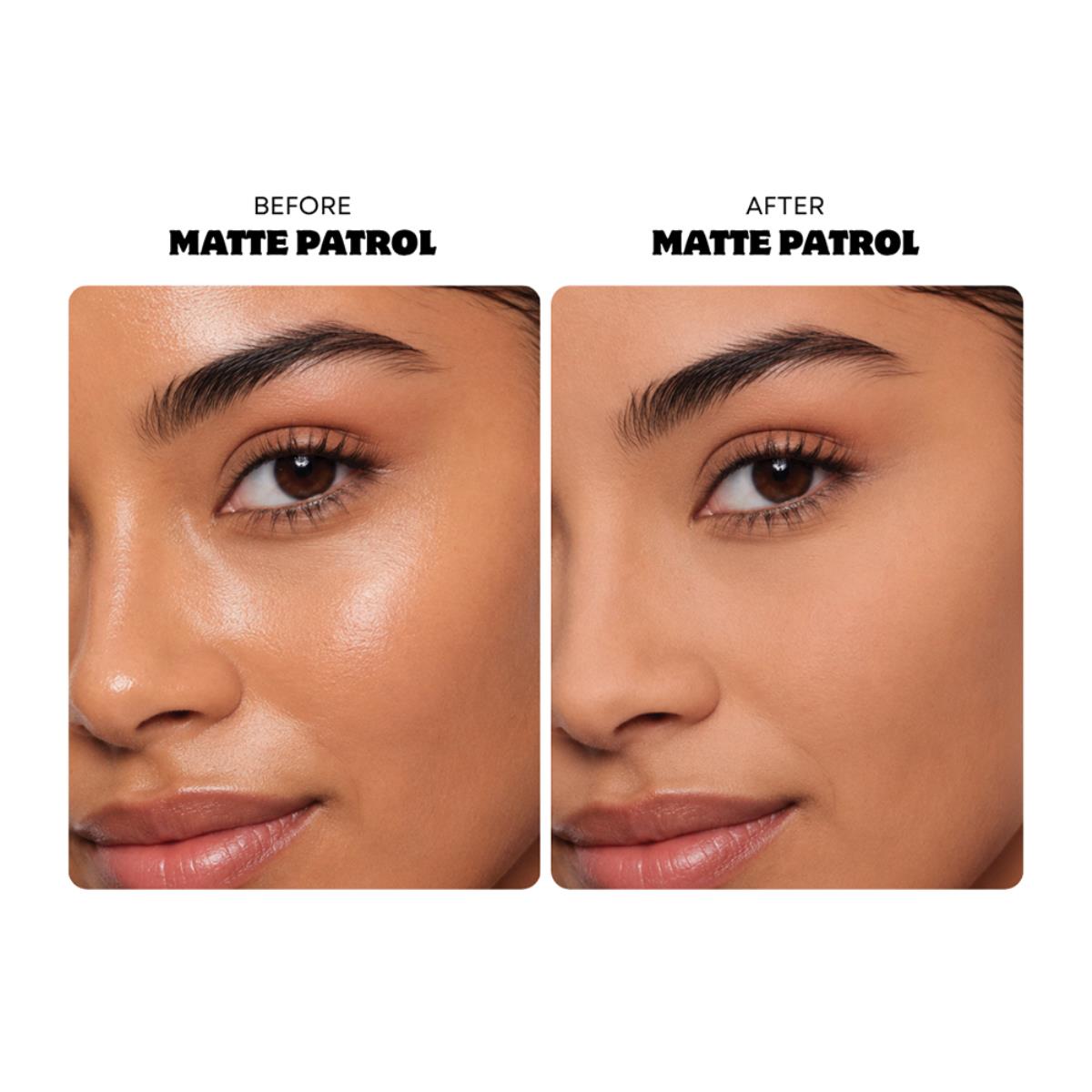 Oz Lab Matte Patrol – vista 2