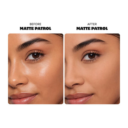 Oz Lab Matte Patrol – vista 2